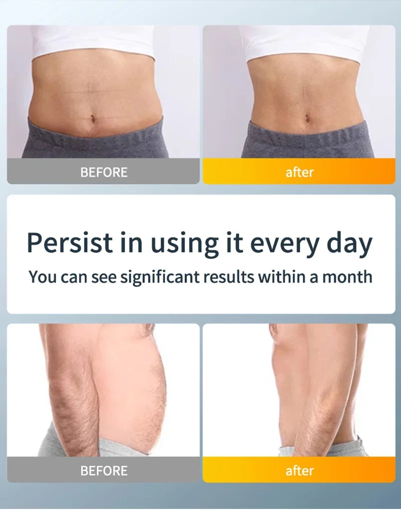 Upgrade Muscle Stimulator Arm Belly Leg Exercise